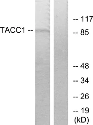 Anti-TACC1 antibody used in Western Blot (WB). GTX87189