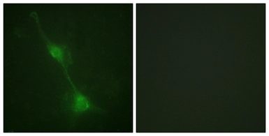 Anti-Ataxin 1 antibody used in Immunocytochemistry/ Immunofluorescence (ICC/IF). GTX87190
