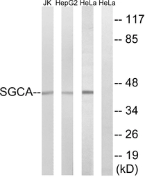 Anti-alpha Sarcoglycan antibody used in Western Blot (WB). GTX87192