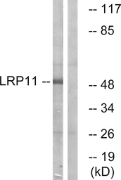 Anti-LRP11 antibody used in Western Blot (WB). GTX87202