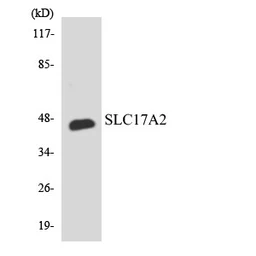 Anti-SLC17A2 antibody used in Western Blot (WB). GTX87203
