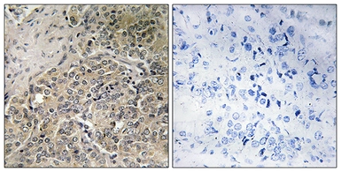 Anti-A26C2 + A26C3 antibody used in IHC (Paraffin sections) (IHC-P). GTX87210