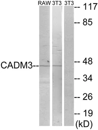 Anti-CADM3 antibody used in Western Blot (WB). GTX87213