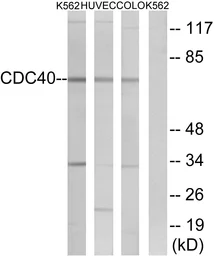 Anti-CDC40 antibody used in Western Blot (WB). GTX87214
