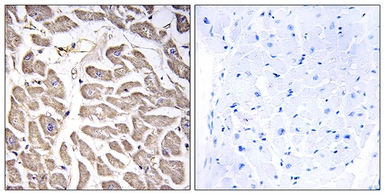 Anti-BRWD3 antibody used in IHC (Paraffin sections) (IHC-P). GTX87222