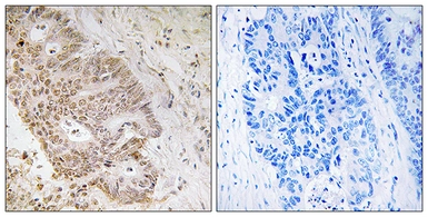 Anti-ZNF592 antibody used in IHC (Paraffin sections) (IHC-P). GTX87224