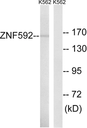 Anti-ZNF592 antibody used in Western Blot (WB). GTX87224