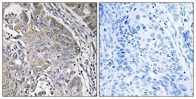 Anti-SPINK6 antibody used in IHC (Paraffin sections) (IHC-P). GTX87230