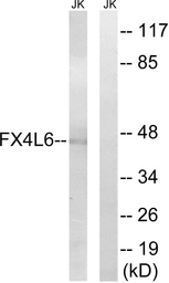 Anti-FOXD4/L2/L3/L4/L5/L6 antibody used in Western Blot (WB). GTX87238