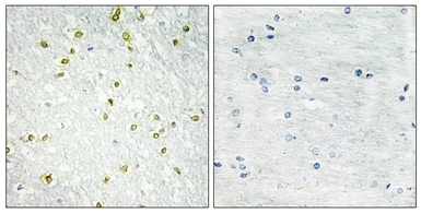 Anti-SNAPC5 antibody used in IHC (Paraffin sections) (IHC-P). GTX87239