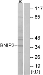 Anti-BNIP2 antibody used in Western Blot (WB). GTX87240