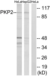 Anti-PKP2 antibody used in Western Blot (WB). GTX87244