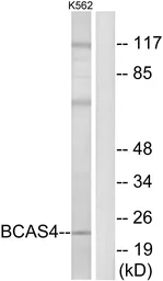 Anti-BCAS4 antibody used in Western Blot (WB). GTX87247