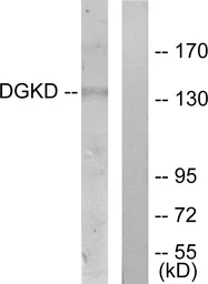 Anti-DGKD antibody used in Western Blot (WB). GTX87254