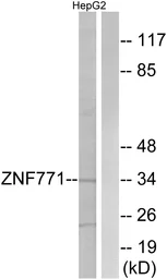 Anti-ZNF771 antibody used in Western Blot (WB). GTX87259