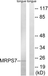 Anti-MRPS7 antibody used in Western Blot (WB). GTX87261