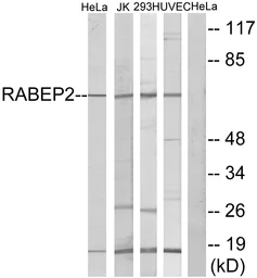 Anti-RABEP2 antibody used in Western Blot (WB). GTX87268