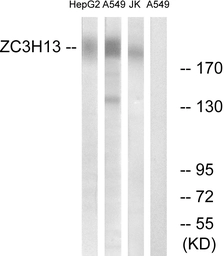 Anti-ZC3H13 antibody used in Western Blot (WB). GTX87273