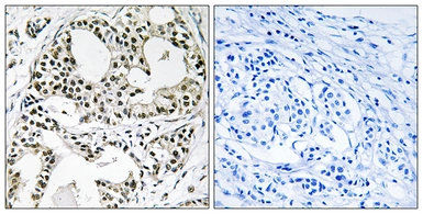 Anti-YEATS2 antibody used in IHC (Paraffin sections) (IHC-P). GTX87275