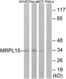 Anti-MRPL15 antibody used in Western Blot (WB). GTX87277