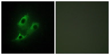 Anti-SERINC2 antibody used in Immunocytochemistry/ Immunofluorescence (ICC/IF). GTX87283