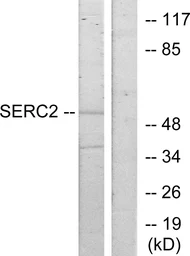 Anti-SERINC2 antibody used in Western Blot (WB). GTX87283