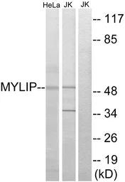 Anti-MYLIP antibody used in Western Blot (WB). GTX87284