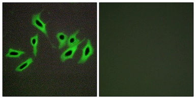 Anti-Heparin Cofactor II antibody used in Immunocytochemistry/ Immunofluorescence (ICC/IF). GTX87285