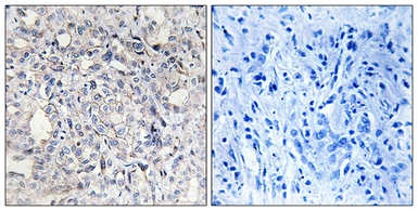 Anti-Heparin Cofactor II antibody used in IHC (Paraffin sections) (IHC-P). GTX87285