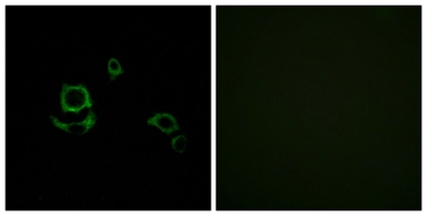Anti-Factor XIIIb antibody used in Immunocytochemistry/ Immunofluorescence (ICC/IF). GTX87291