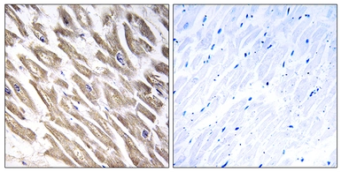 Anti-Factor XIIIb antibody used in IHC (Paraffin sections) (IHC-P). GTX87291
