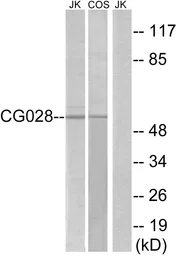 Anti-CCZ1B antibody used in Western Blot (WB). GTX87298