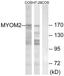 Anti-MYOM2 antibody used in Western Blot (WB). GTX87299