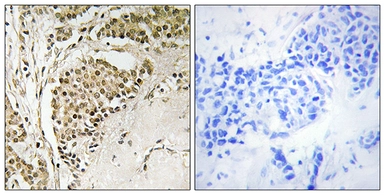 Anti-NOM1 antibody used in IHC (Paraffin sections) (IHC-P). GTX87304