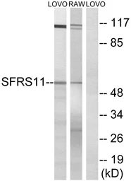 Anti-SFRS11 antibody used in Western Blot (WB). GTX87310