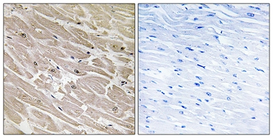 Anti-MRPL46 antibody used in IHC (Paraffin sections) (IHC-P). GTX87311
