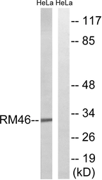 Anti-MRPL46 antibody used in Western Blot (WB). GTX87311