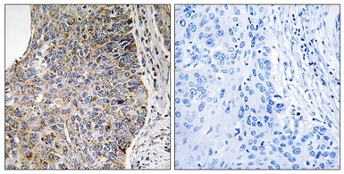 Anti-NEK7 antibody used in IHC (Paraffin sections) (IHC-P). GTX87316