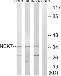 Anti-NEK7 antibody used in Western Blot (WB). GTX87316