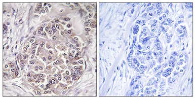Anti-PEX1 antibody used in IHC (Paraffin sections) (IHC-P). GTX87318
