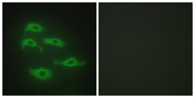Anti-TDE1 antibody used in Immunocytochemistry/ Immunofluorescence (ICC/IF). GTX87321