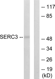 Anti-TDE1 antibody used in Western Blot (WB). GTX87321