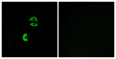 Anti-LDLRAD3 antibody used in Immunocytochemistry/ Immunofluorescence (ICC/IF). GTX87322