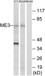 Anti-ME3 antibody used in Western Blot (WB). GTX87324