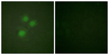 Anti-NIFK antibody used in Immunocytochemistry/ Immunofluorescence (ICC/IF). GTX87326