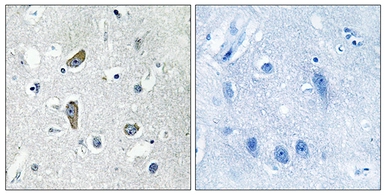 Anti-CDK5RAP2 antibody used in IHC (Paraffin sections) (IHC-P). GTX87345
