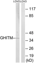 Anti-GHITM antibody used in Western Blot (WB). GTX87350