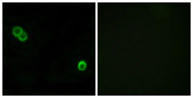 Anti-ACER3 antibody used in Immunocytochemistry/ Immunofluorescence (ICC/IF). GTX87351