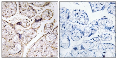 Anti-ACER3 antibody used in IHC (Paraffin sections) (IHC-P). GTX87351