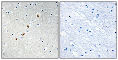 Anti-ZNF596 antibody used in IHC (Paraffin sections) (IHC-P). GTX87352